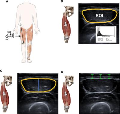 Centile reference curves of the ultrasound-based characteristics of the rectus femoris muscle composition in children at 4–11 years old